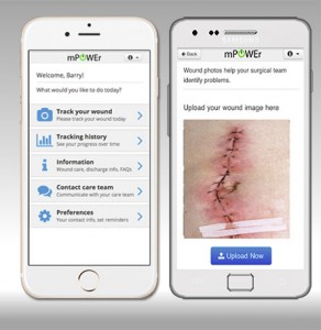 With mPOWEr, users can track symptoms of infection, monitor incisions with photos, and communicate with surgical teams.